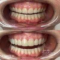  smilesolution06